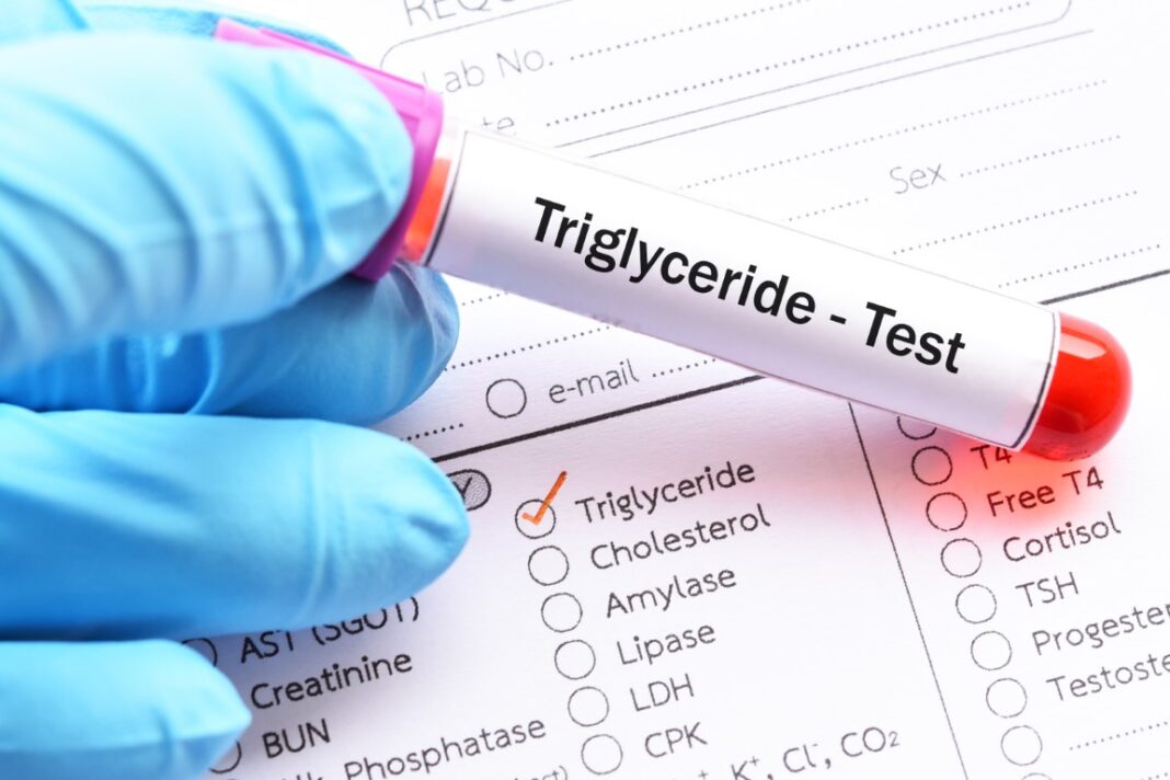 Analyse du taux de triglycérides