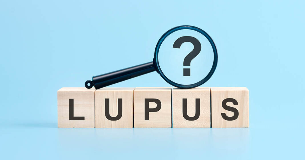 Soigner le lupus pourrait devenir une réalité grâce à cette découverte